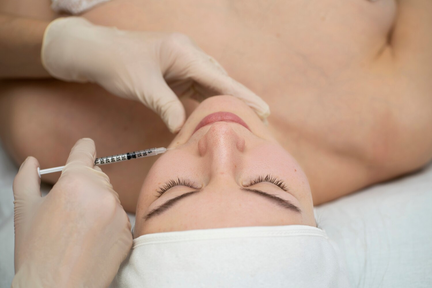 Biorevitalizare